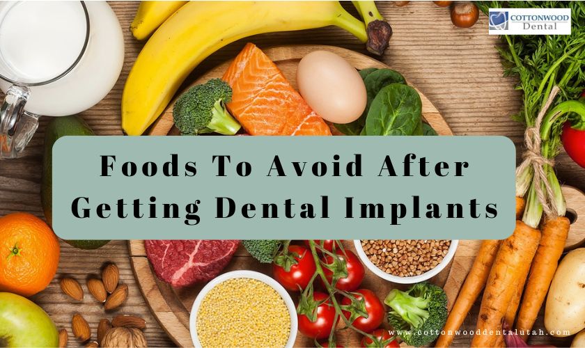 Foods To Avoid After Getting Dental Implants